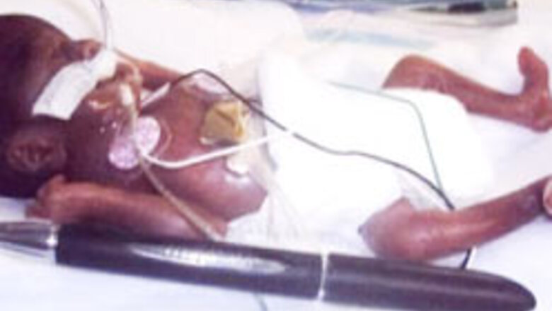 Miracle baby to be discharged soon