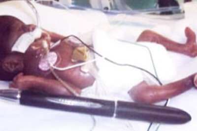 Miracle baby to be discharged soon