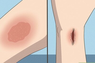 How to Know when You Need a Tetanus Shot