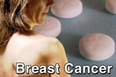MRI helps women with breast cancer risk